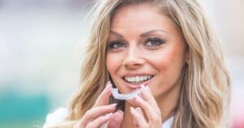 Tolco - Invisalign la méthode d'alignement des dents qui plait aux adultes