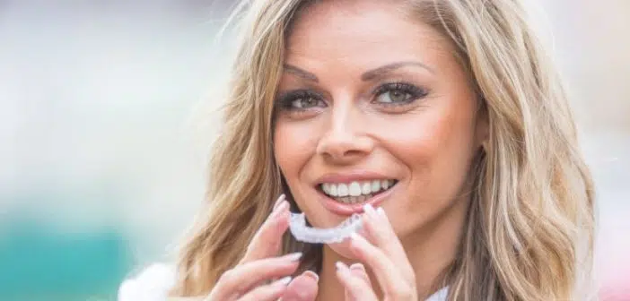 Tolco - Invisalign la méthode d'alignement des dents qui plait aux adultes