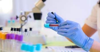 Où trouver un laboratoire de biologie médicale à Nice ?